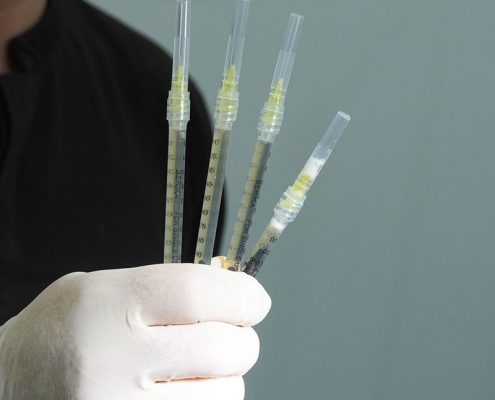 Traitement capillaire cellules souches byhairclinic