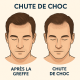 Chute de Choc après une Greffe de Cheveux