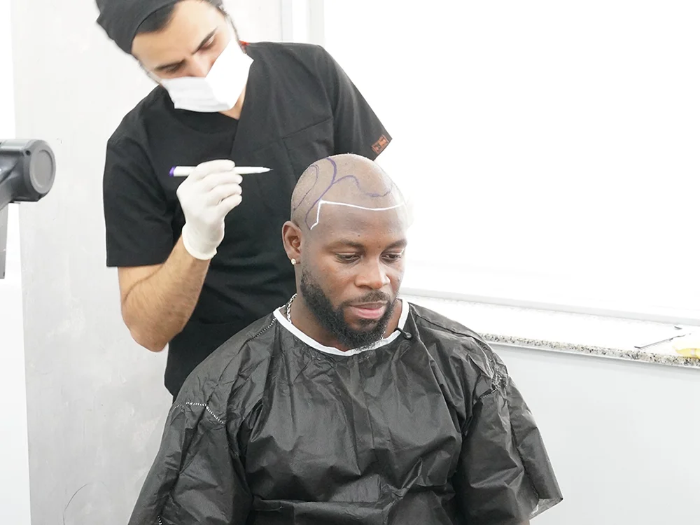 Greffe de Cheveux de Noé D’Almeida en Turquie 6 Préparation de l’intervention de greffe de cheveux de Noé à Istanbul