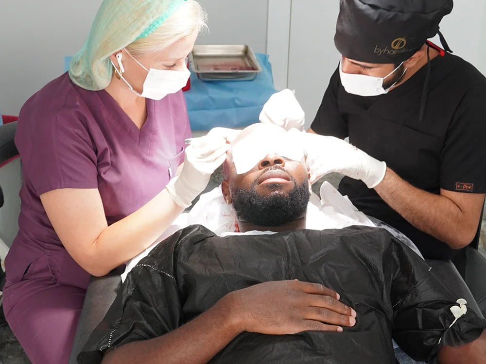 Greffe de Cheveux de Noé D’Almeida en Turquie 8 Placement des greffons lors de la greffe de cheveux de Noé chez byhairclinic